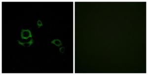 Immunofluorescence analysis of HUVEC cells using Anti-F13B Antibody The right hand panel represents a negative control, where the antibody was pre-incubated with the immunising peptide