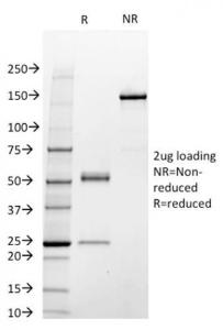 SDS-PAGE analysis of Anti-STAT3 Antibody [STAT3/2409] under non-reduced and reduced conditions; showing intact IgG and intact heavy and light chains, respectively SDS-PAGE analysis confirms the integrity and purity of the antibody