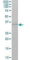 Anti-TRD Mouse Monoclonal Antibody [clone: 2H6]