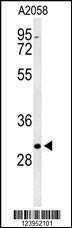 Anti-BASP1 Rabbit Polyclonal Antibody (AP (Alkaline Phosphatase))