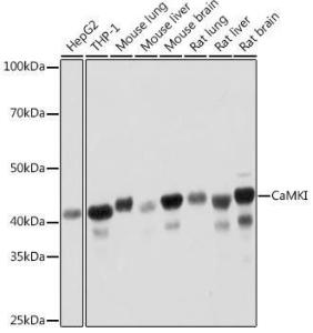 Anti-CaMKI Rabbit Monoclonal Antibody [clone: ARC2030]