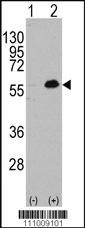 Anti-MEF2C Rabbit Polyclonal Antibody