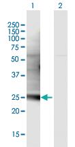 Anti-C1QL3 Mouse Polyclonal Antibody