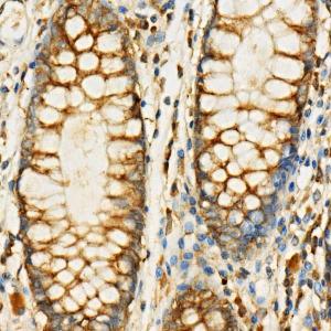 Anti-eIF4G1 Rabbit Polyclonal Antibody