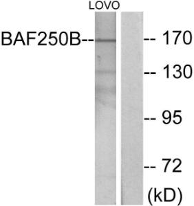 Western blot analysis of lysates from LOVO cells using Anti-BAF250B Antibody. The right hand lane represents a negative control, where the antibody is blocked by the immunising peptide