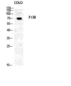 Western blot analysis of COLO cells using Anti-F13B Antibody