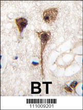 Anti-PIGH Rabbit Polyclonal Antibody