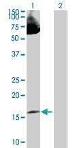 Anti-LMO2 Rabbit Polyclonal Antibody