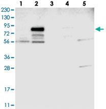 Anti-ATP6V0A4 Rabbit Polyclonal Antibody