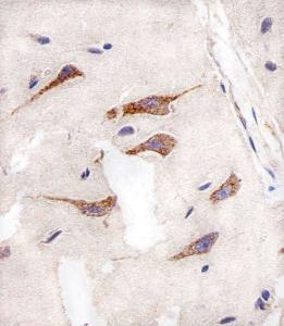 Anti-AURKA Mouse Monoclonal Antibody [clone: 1364CT291.108.155]