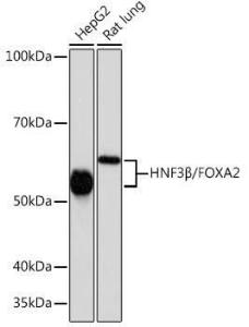 Western blot analysis of extracts of various cell lines, using Anti-FOXA2 Antibody [ARC0391] (A307499) at 1:1,000 dilution