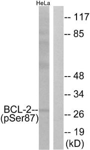 Western blot analysis of lysates from HeLa cells treated with nocodazole 1 µg/ml 18h using Anti-BCL-2 (phospho Ser87) Antibody. The right hand lane represents a negative control, where the Antibody is blocked by the immunising peptide