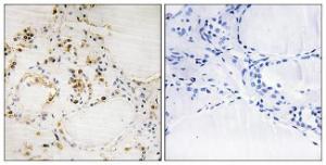 Immunohistochemical analysis of paraffin-embedded human thyroid gland using Anti-BCL-2 (phospho Ser87) Antibody. The right hand panel represents a negative control, where the Antibody was pre-incubated with the immunising peptide