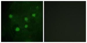 Immunofluorescence analysis of HUVEC cells using Anti-BAF250B Antibody. The right hand panel represents a negative control, where the antibody was pre-incubated with the immunising peptide