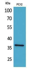 Anti-F11R antibody