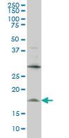 Anti-LMO2 Mouse Monoclonal Antibody [clone: 6B8]