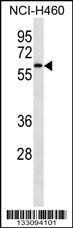 Anti-IRAK4 Rabbit Polyclonal Antibody (HRP (Horseradish Peroxidase))