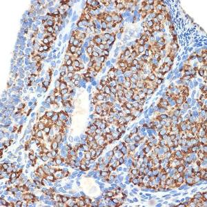 Immunohistochemistry analysis of paraffin-embedded rat ovary using Anti-HSD3B1 Antibody [ARC2437] (A308449) at a dilution of 1:100 (40X lens). Perform microwave antigen retrieval with 10 mM Tris/EDTA buffer pH 9.0 before commencing with IHC staining protocol