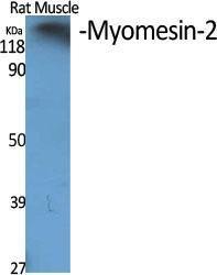 Western blot analysis of various cells using Anti-MYOM2 Antibody