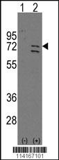 Anti-PARP6 Rabbit Polyclonal Antibody