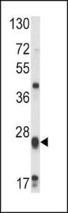 Anti-GSTM1 Rabbit Polyclonal Antibody (Biotin)