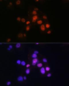 Immunofluorescence analysis of Hep G2 cells using Anti-FOXA2 Antibody [ARC0391] (A307499) at a dilution of 1:100 (40X lens). DAPI was used to stain the cell nuclei (blue)