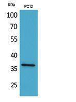 Anti-F11R antibody