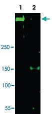 Anti-ATR Rabbit Polyclonal Antibody