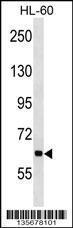 Anti-ANKHD1 Rabbit Polyclonal Antibody (Biotin)