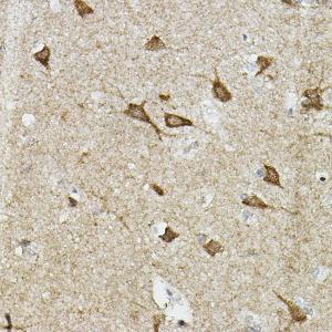 Immunohistochemistry analysis of paraffin-embedded human brain tissue using Anti-HIF-2-alpha Antibody (A10163) at a dilution of 1:100 (40X lens). Perform high pressure antigen retrieval with 10 mM citrate buffer pH 6.0 before commencing with IHC staining protocol