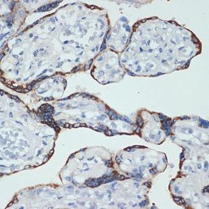 Immunohistochemistry analysis of paraffin-embedded human placenta using Anti-HSD3B1 Antibody [ARC2437] (A308449) at a dilution of 1:100 (40X lens). Perform microwave antigen retrieval with 10 mM Tris/EDTA buffer pH 9.0 before commencing with IHC staining protocol