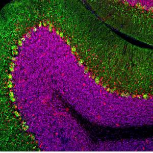 Immunofluorescent analysis of rat cerebellum section stained with Anti-MeCP2 Antibody (1:500/red) and co-stained with Anti-Calbindin Antibody (1:2,000/green)