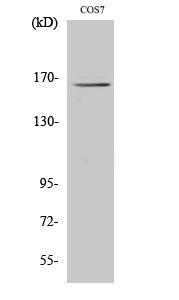 Western blot analysis of HT29 cells using Anti-MYOM2 Antibody