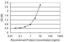 Anti-SERPINA3 Polyclonal Antibody Pair