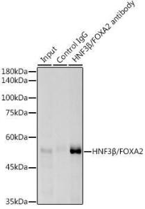 Immunoprecipitation analysis of 300 µg extracts of HepG2 cells using 3 µg of Anti-FOXA2 Antibody [ARC0391] (A307499). This Western blot was performed on the immunoprecipitate using Anti-FOXA2 Antibody [ARC0391] (A307499) at a dilution of 1:1000