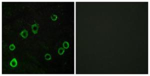 Immunofluorescence analysis of LOVO cells using Anti-ADORA2A Antibody. The right hand panel represents a negative control, where the antibody was pre-incubated with the immunising peptide.