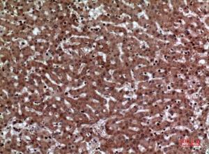 Anti-F11R antibody