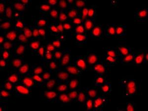 Immunofluorescence analysis of A549 cells using Anti-HIF-2-alpha Antibody (A10163)