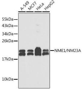 Western blot analysis of extracts of various cell lines, using Anti-NM23A Antibody (A307500). The secondary antibody was Goat Anti-Rabbit IgG H and L Antibody (HRP) at 1:10,000 dilution. Lysates/proteins were present at 25 µg per lane. The blocking buffer used was 3% non-fat dry milk in TBST