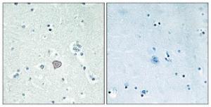 Immunohistochemical analysis of paraffin-embedded human brain tissue using Anti-ADORA2A Antibody. The right hand panel represents a negative control, where the antibody was pre-incubated with the immunising peptide.