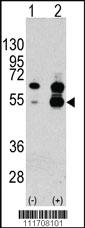 Anti-VEGFA Rabbit Polyclonal Antibody