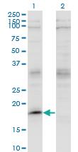 Anti-LMO2 Mouse Monoclonal Antibody [clone: 4E2]