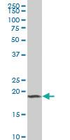 Anti-TCTE3 Mouse Polyclonal Antibody