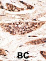 Anti-TAP1 Rabbit Polyclonal Antibody (HRP (Horseradish Peroxidase))