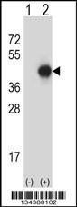 Anti-GNAI2 Rabbit Polyclonal Antibody (Biotin)