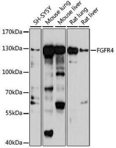 Anti-FGFR4 Rabbit Polyclonal Antibody