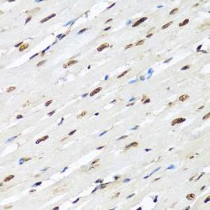 Immunohistochemistry analysis of paraffin-embedded rat heart using Anti-hnRNP R Antibody (A308450) at a dilution of 1:100 (40X lens). Perform microwave antigen retrieval with 10 mM PBS buffer pH 7.2 before commencing with IHC staining protocol