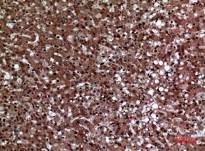 Anti-F11R antibody