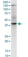 Anti-RNF2 Mouse Monoclonal Antibody [clone: 4A9]