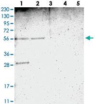 Anti-TMEM180 Rabbit Polyclonal Antibody